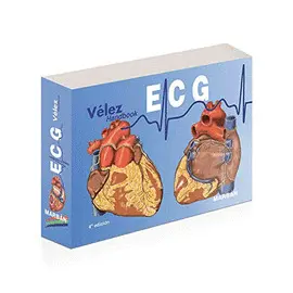 ECG HANDBOOK